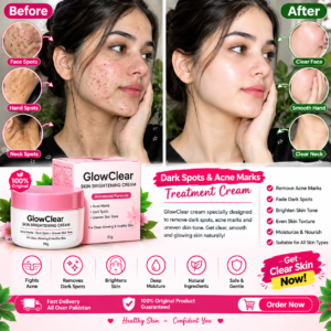 GlowClear Skin Brightening Cream – Advanced Formula for Acne Marks, Dark Spots & Uneven Skin Tone