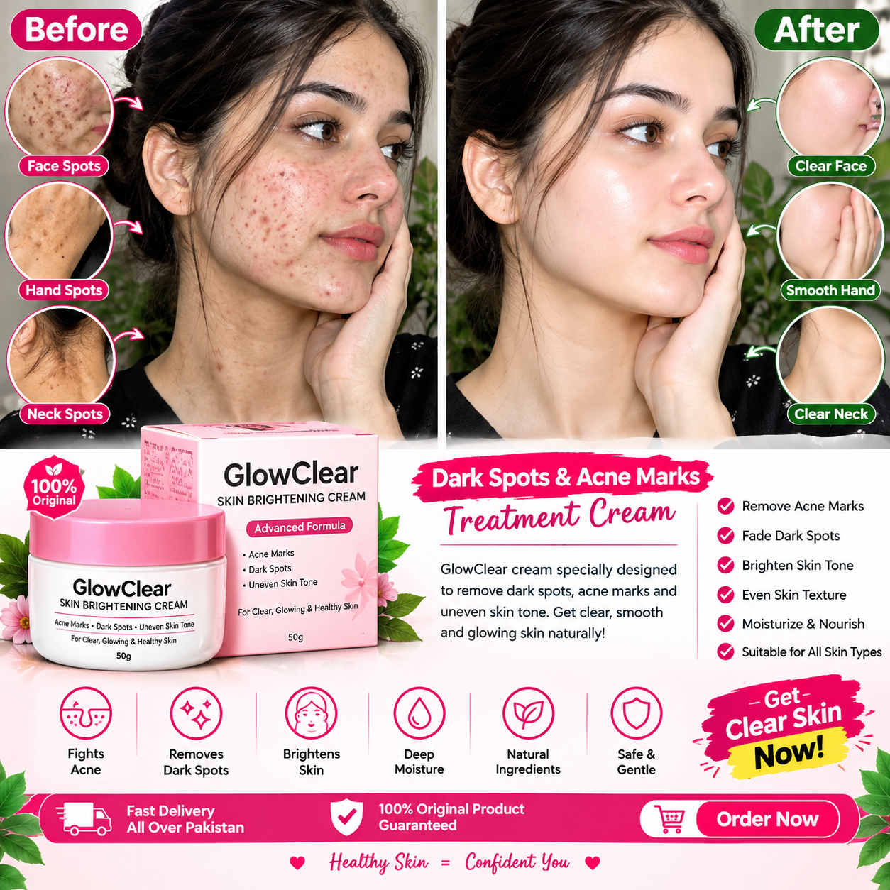 GlowClear Skin Brightening Cream – Advanced Formula for Acne Marks, Dark Spots & Uneven Skin Tone
